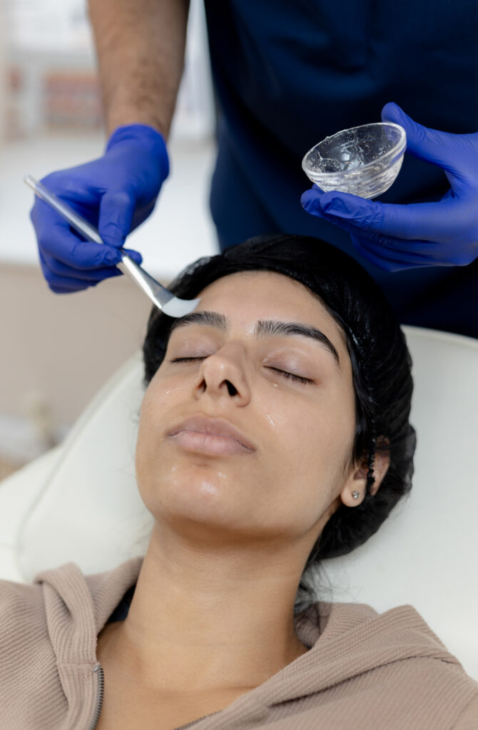 chemical peel images